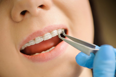 دانلود مقاله ارتودنسی و دندانپزشکی